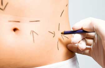 Ideally Cirurgia Plástica e Estética - Foto 1