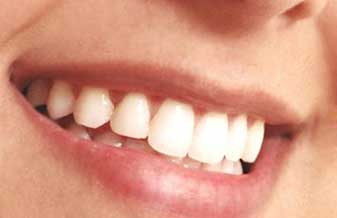 Pró Dentes Odontologia - Foto 1